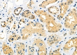 Invitrogen RTRAF Polyclonal Antibody 100 μL; Unconjugated:Antibodies,