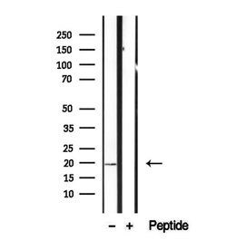 Invitrogen CPLX2 Polyclonal Antibody 100 μL; Unconjugated:Antibodies,
