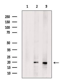 Invitrogen CPLX2 Polyclonal Antibody 100 μL; Unconjugated:Antibodies,