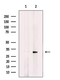 Invitrogen CTHRC1 Polyclonal Antibody 100 &mu;L; Unconjugated:Antibodies,