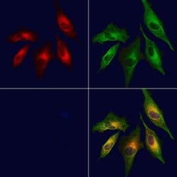 Invitrogen CXCL14 Polyclonal Antibody 100 &mu;L; Unconjugated:Antibodies,