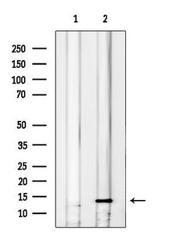 Invitrogen CXCL14 Polyclonal Antibody 100 &mu;L; Unconjugated:Antibodies,