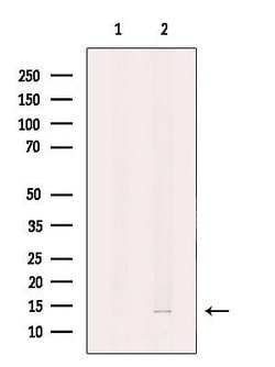 Invitrogen DNAJC19 Polyclonal Antibody 100 μL; Unconjugated:Antibodies,