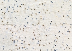 Invitrogen E2F3 Polyclonal Antibody 100 &mu;L; Unconjugated:Antibodies,