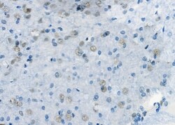 Invitrogen E2F3 Polyclonal Antibody 100 &mu;L; Unconjugated:Antibodies,