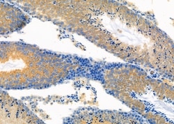 Invitrogen EGFL7 Polyclonal Antibody 100 &mu;L; Unconjugated:Antibodies,