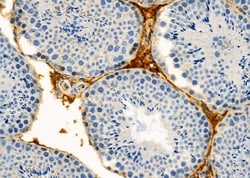 Invitrogen eIF2b alpha Polyclonal Antibody 100 &mu;L; Unconjugated:Antibodies,
