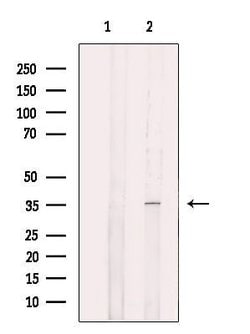 Invitrogen eIF2b alpha Polyclonal Antibody 100 &mu;L; Unconjugated:Antibodies,