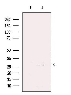 Invitrogen GSTM3 Polyclonal Antibody 100 μL; Unconjugated:Antibodies,