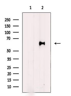 Invitrogen HPSE Polyclonal Antibody 100 &mu;L | Buy Online | Invitrogen&trade; | Fisher Scientific
