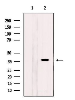 Invitrogen KCTD12 Polyclonal Antibody 100 &mu;L; Unconjugated:Antibodies,
