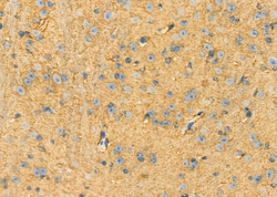 Invitrogen LGP2 Polyclonal Antibody 100 &mu;L; Unconjugated:Antibodies,