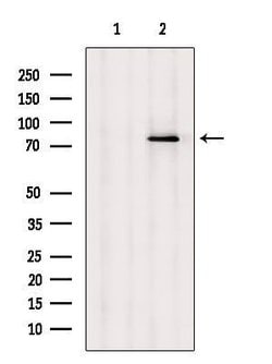 Invitrogen LGP2 Polyclonal Antibody 100 &mu;L; Unconjugated:Antibodies,