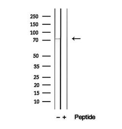 Invitrogen LGP2 Polyclonal Antibody 100 &mu;L; Unconjugated:Antibodies,