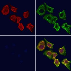 Invitrogen PARVB Polyclonal Antibody 100 &mu;L; Unconjugated:Antibodies,