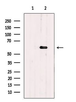 Invitrogen PHF17 Polyclonal Antibody 100 &mu;L | Buy Online | Invitrogen&trade; | Fisher Scientific