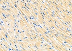 Invitrogen PIP5K1A Polyclonal Antibody 100 &mu;L; Unconjugated:Antibodies,