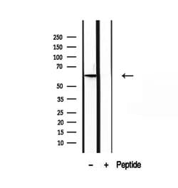 Invitrogen PIP5K1A Polyclonal Antibody 100 &mu;L; Unconjugated:Antibodies,