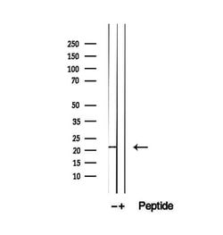 Invitrogen PRL1 Polyclonal Antibody 100 &mu;L; Unconjugated:Antibodies,