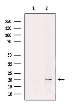 Invitrogen REEP6 Polyclonal Antibody 100 &mu;L; Unconjugated:Antibodies,