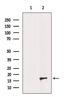 Invitrogen RPS14 Polyclonal Antibody 100 &mu;L; Unconjugated:Antibodies,