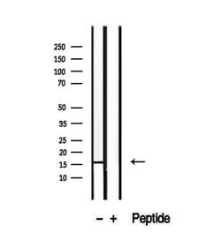 Invitrogen RPS14 Polyclonal Antibody 100 &mu;L; Unconjugated:Antibodies,
