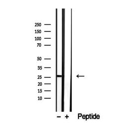 Invitrogen SAT1 Polyclonal Antibody 100 &mu;L; Unconjugated:Antibodies,