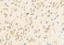 Invitrogen EXOC3 Polyclonal Antibody 100 &mu;L; Unconjugated:Antibodies,