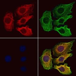 Invitrogen SLC13A2 Polyclonal Antibody 100 &mu;L; Unconjugated:Antibodies,