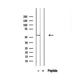 Invitrogen SLC13A2 Polyclonal Antibody 100 &mu;L; Unconjugated:Antibodies,