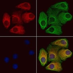Invitrogen SRPX2 Polyclonal Antibody 100 &mu;L | Buy Online | Invitrogen&trade; | Fisher Scientific