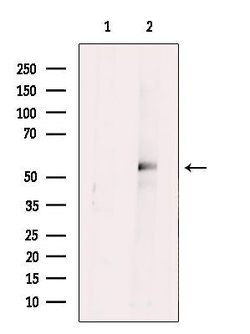 Invitrogen SRPX2 Polyclonal Antibody 100 &mu;L | Buy Online | Invitrogen&trade; | Fisher Scientific
