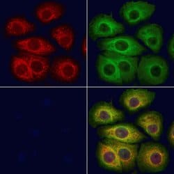 Invitrogen TCTN2 Polyclonal Antibody 100 &mu;L; Unconjugated:Antibodies,
