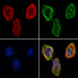 Invitrogen TCTN2 Polyclonal Antibody 100 &mu;L; Unconjugated:Antibodies,