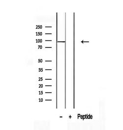 Invitrogen TCTN2 Polyclonal Antibody 100 &mu;L; Unconjugated:Antibodies,