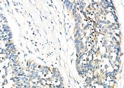 Invitrogen TIMM9 Polyclonal Antibody 100 &mu;L; Unconjugated:Antibodies,