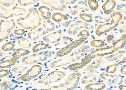 Invitrogen TIMM9 Polyclonal Antibody 100 &mu;L; Unconjugated:Antibodies,