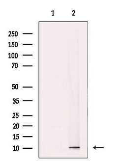Invitrogen TIMM9 Polyclonal Antibody 100 &mu;L; Unconjugated:Antibodies,