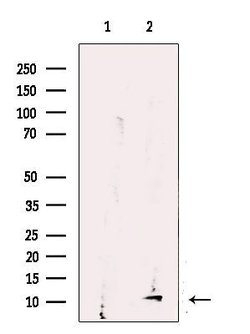 Invitrogen UQCRQ Polyclonal Antibody 100 &mu;L; Unconjugated:Antibodies,