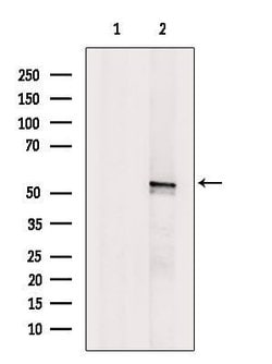 Invitrogen WISP1 Polyclonal Antibody 100 &mu;L; Unconjugated:Antibodies,
