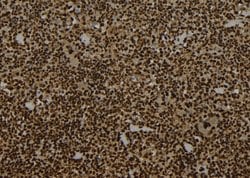 Invitrogen WRAP53 Polyclonal Antibody 100 &mu;L; Unconjugated:Antibodies,