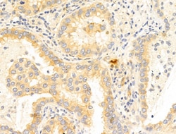 Invitrogen WWP1 Polyclonal Antibody 100 &mu;L; Unconjugated:Antibodies,