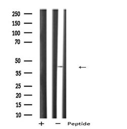 Invitrogen PDHA2 Polyclonal Antibody 100 μL; Unconjugated:Antibodies,