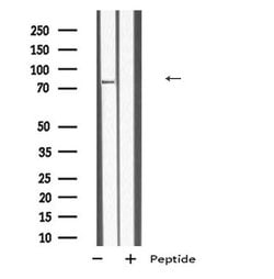 Invitrogen TBC1D10B Polyclonal Antibody 100 &mu;L; Unconjugated:Antibodies,