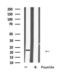 Invitrogen HIV1 (Virion infectivity factor) Polyclonal Antibody 100 μL;