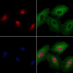 Invitrogen c-MAF Polyclonal Antibody 100 μL; Unconjugated:Antibodies,