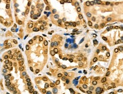 Invitrogen DGKI Polyclonal Antibody 100 μL; Unconjugated:Antibodies,