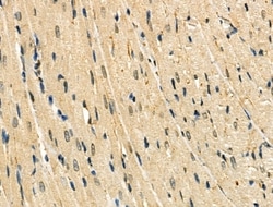 Invitrogen NR2F6 Polyclonal Antibody 100 &mu;L; Unconjugated:Antibodies,
