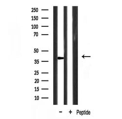 Invitrogen NR2F6 Polyclonal Antibody 100 &mu;L; Unconjugated:Antibodies,