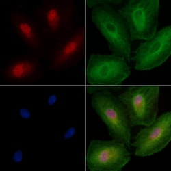 Invitrogen ZNF18 Polyclonal Antibody 100 &mu;L; Unconjugated:Antibodies,